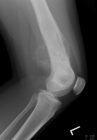 Zoom image: Radiological image