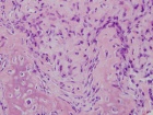 Zoom image: Cell stain