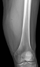 Zoom image: Radiological image