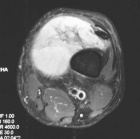 Zoom image: Radiological image