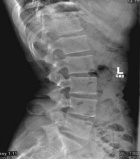 Zoom image: Radiological image