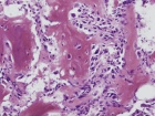 Zoom image: Cell stain