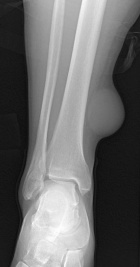 Zoom image: Radiological image