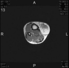 Zoom image: Radiological image