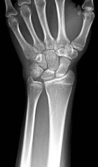 Zoom image: Radiological image