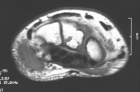Zoom image: Radiological image