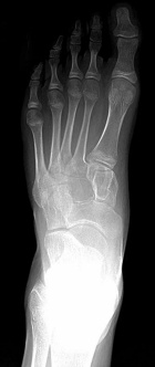 Zoom image: Radiological image