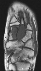 Zoom image: Radiological image