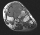 Zoom image: Radiological image