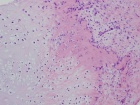 Zoom image: Cell stain