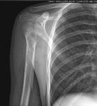 Zoom image: Radiological image