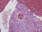 Zoom image: Cell stain