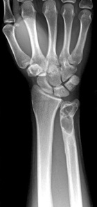 Zoom image: Radiological image