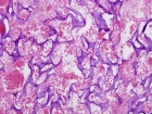 Zoom image: Cell stain