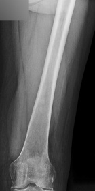 Zoom image: Radiological image