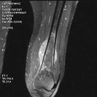 Zoom image: Radiological image