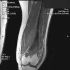 Zoom image: Radiological image