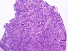 Zoom image: Cell stain