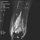 Zoom image: Radiological image