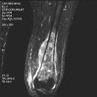 Zoom image: Radiological image