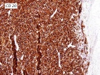 Zoom image: Cell stain
