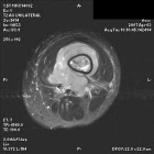 Zoom image: Radiological image