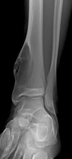 Zoom image: Radiological image