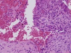 Zoom image: Cell stain