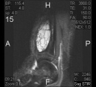 Zoom image: Radiological image