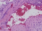 Zoom image: Cell stain