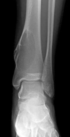 Zoom image: Radiological image