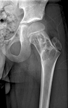 Zoom image: Radiological image