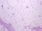 Zoom image: Cell stain
