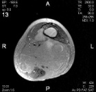 Zoom image: Radiological image
