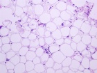 Zoom image: Cell stain