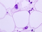 Zoom image: Cell stain