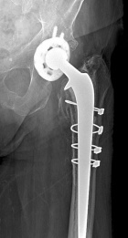 Zoom image: Radiological image