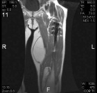 Zoom image: Radiological image