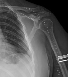 Zoom image: Radiological image