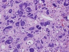 Zoom image: Cell stain