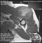 Zoom image: Radiological image