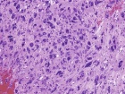Zoom image: Cell stain