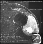 Zoom image: Radiological image