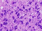 Zoom image: Cell stain