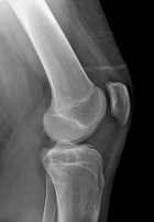 Zoom image: Radiological image