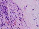 Zoom image: Cell stain