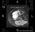 Zoom image: Radiological image