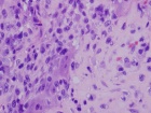 Zoom image: Cell stain