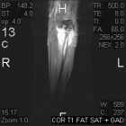 Zoom image: Radiological image