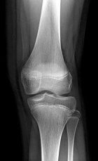 Zoom image: Radiological image